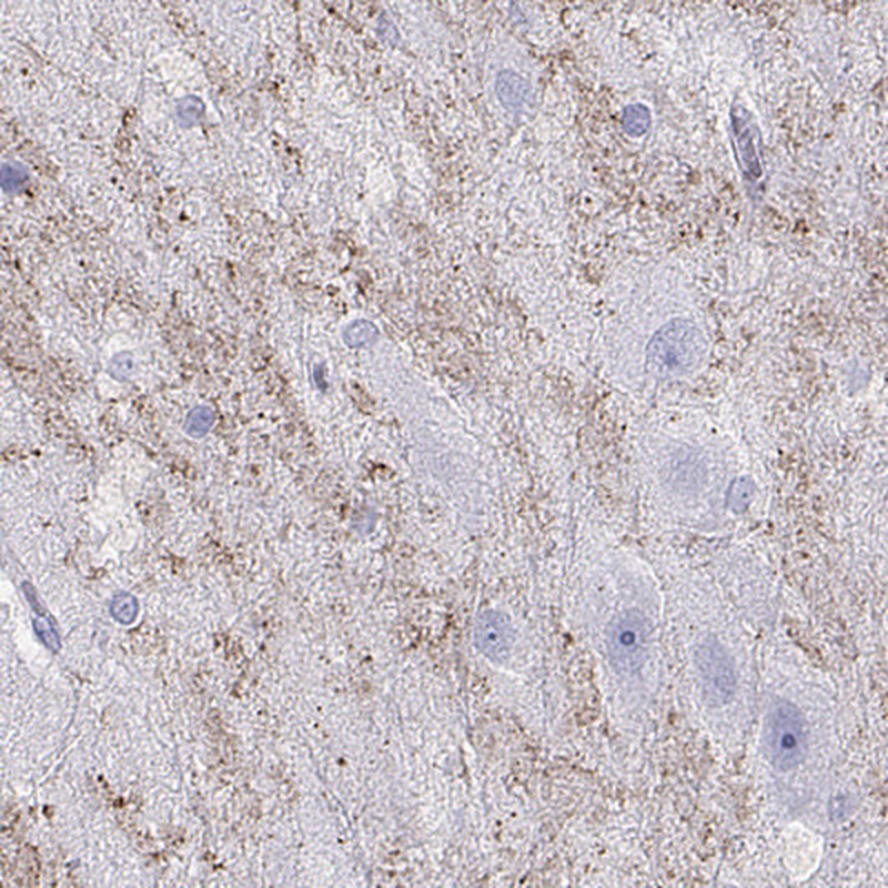 Anti-HHLA1 Antibody