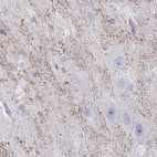 Anti-HHLA1 Antibody