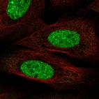 Anti-CPEB3 Antibody