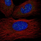 Anti-TINF2 Antibody