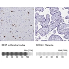 Anti-BEX5 Antibody