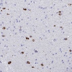 Anti-BEX5 Antibody