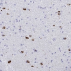 Immunohistochemical staining of human cerebral cortex shows high expression.