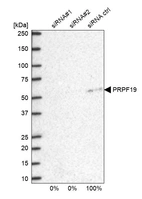 Western blot analysis in U2OS cells transfected with control siRNA, target specific siRNA probe #1 and #2, using Anti-PRPF19 antibody. Remaining relative intensity is presented.