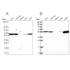 Western blot analysis using Anti-PRPF19 antibody HPA059070 (A) shows similar pattern to independent antibody HPA038051 (B).