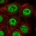 Immunofluorescent staining of human cell line MCF7 shows localization to nuclear speckles.