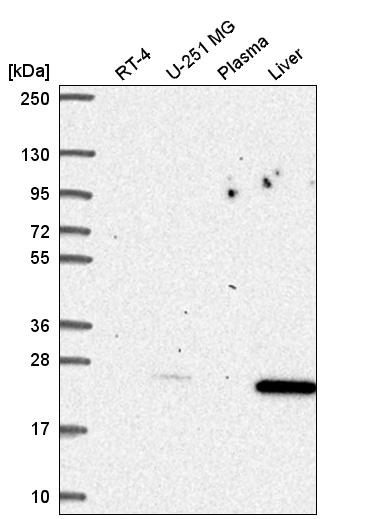 Anti-CDKN1B Antibody