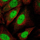 Immunofluorescent staining of human cell line SiHa shows localization to nucleus.