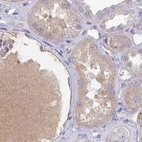 Immunohistochemical staining of human kidney using Anti-HGFAC antibody HPA059076.
