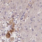 Immunohistochemical staining of human liver using Anti-HGFAC antibody HPA059076.
