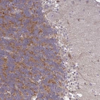 Anti-GPRIN3 Antibody