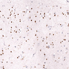 Immunohistochemical staining of human cerebral cortex shows strong nuclear positivity in neurons.