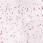 Immunohistochemical staining of human cerebral cortex shows strong nuclear positivity in neurons.