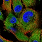 Anti-ZC3HAV1 Antibody
