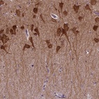 Anti-PRRT1 Antibody