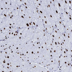 Immunohistochemical staining of human heart muscle shows strong nuclear positivity in cardiomyocytes.