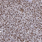 Immunohistochemical staining of human pancreas shows strong nuclear positivity in exocrine glandular cells.