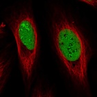 Anti-GAR1 Antibody