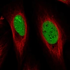 Immunofluorescent staining of human cell line U-2 OS shows localization to nucleus & nucleoli fibrillar center.
