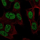 Anti-RALYL Antibody