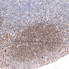 Immunohistochemical staining of human tonsil shows strong nuclear positivity in germinal center cells.