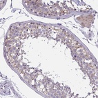 Anti-TCEAL8 Antibody