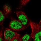 Immunofluorescent staining of human cell line RH-30 shows localization to nucleoplasm.