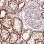 Immunohistochemical staining of human kidney shows strong granular cytoplasmic positivity in cells in tubules.