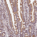 Immunohistochemical staining of human duodenum shows strong granular cytoplasmic positivity in glandular cells.