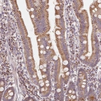 Immunohistochemical staining of human duodenum shows strong granular cytoplasmic positivity in glandular cells.