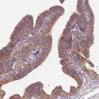 Immunohistochemical staining of human fallopian tube shows moderate granular cytoplasmic positivity in glandular cells.