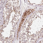 Immunohistochemical staining of human testis shows strong granular cytoplasmic positivity in Leydig cells.