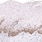 Immunohistochemical staining of human cervix shows strong nuclear positivity in squamous epithelial cells.