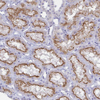 Immunohistochemical staining of human kidney shows moderate membranous positivity in cells in tubules.