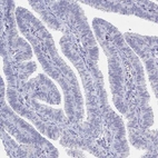 Immunohistochemical staining of human fallopian tube shows no positivity in glandular cells as expected.