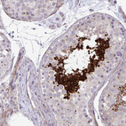 Anti-FUNDC2 Antibody