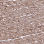 Immunohistochemical staining of human heart muscle shows moderate cytoplasmic positivity in cardiomyocytes.