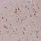Immunohistochemical staining of human cerebral cortex shows moderate cytoplasmic positivity in neurons.