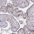 Immunohistochemical staining of human Placenta shows strong granular cytoplasmic positivity in trophoblastic cells.