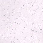 Immunohistochemical staining of human skeletal muscle shows no positivity in myocytes as expected.