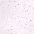 Immunohistochemical staining of human skeletal muscle shows no positivity in myocytes as expected.