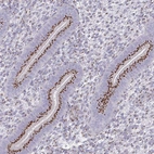 Immunohistochemical staining of human Endometrium shows strong granular cytoplasmic positivity in glandular cells.