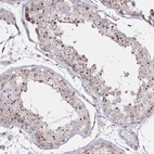 Immunohistochemical staining of human Testis shows strong granular cytoplasmic positivity in cells in seminiferous ducts.