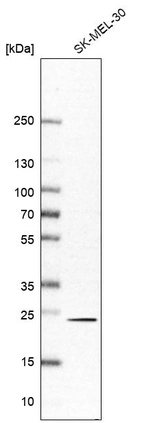 Western blot analysis in human cell line SK-MEL-30.