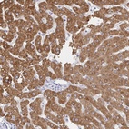 Anti-ZNF100 Antibody