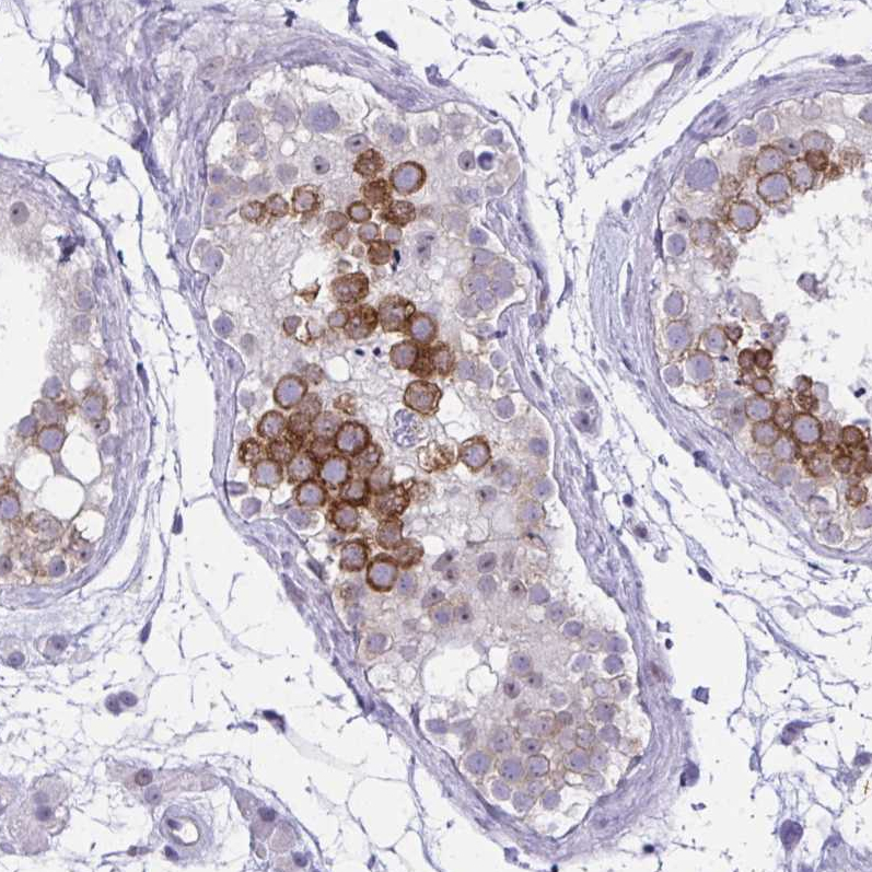 Anti-NFXL1 Antibody