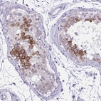 Anti-NFXL1 Antibody