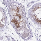Anti-NFXL1 Antibody