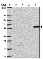 Lane 1: Marker [kDa] 250, 130, 95, 72, 55, 36, 28, 17, 10_br/_Lane 2: Human cell line RT-4_br/_Lane 3: Human cell line U-251MG sp_br/_Lane 4: Human plasma (IgG/HSA depleted)_br/_Lane 5: Human liver tissue
