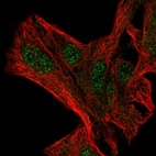 Immunofluorescent staining of human cell line Hep G2 shows localization to nucleoplasm.